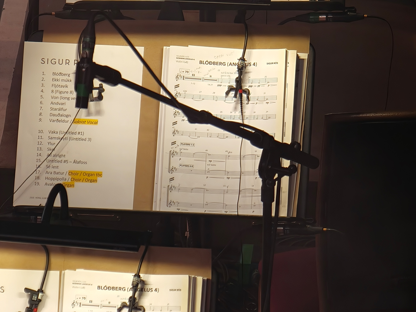 Oppo Find X9 Pro Hasselblad extender lens zoom