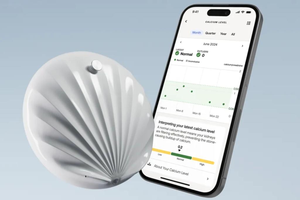 Withings U-Scan and App