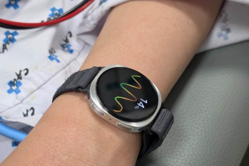 Fainting prediction will be the next major Samsung Galaxy Watch health feature